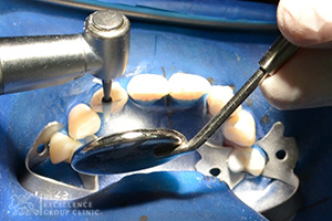 Cosmetic Dentistry 2