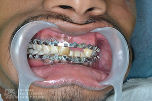 Oral Surgery 2